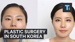 Plastic surgery in South Korea [upl. by Nylsirk531]