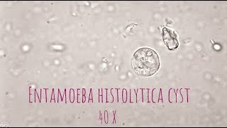 Entamoeba Histolytica cyst under microscope at 40X [upl. by Ahcire]