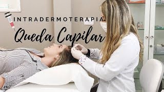 Meu tratamento capilar para queda de cabelo  Intradermoterapia Capilar [upl. by Netsud]