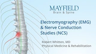 Your Radiologist Explains Myelography [upl. by Acey884]