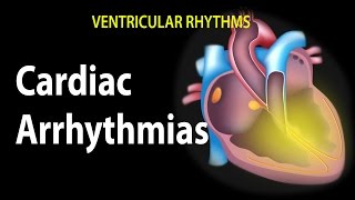 Cardiac Arrhythmias Animation [upl. by Dranek]