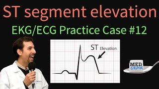 Increased Intracranial Pressure  ICP  EMTprepcom [upl. by Adirahs]