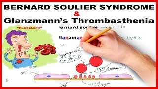 Bernard Soulier Syndrome amp Glanzmanns Thrombasthenia  Mnemonic Series  21 [upl. by Emlen234]