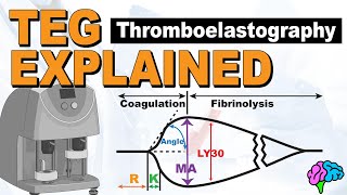 TEG Explained  Understanding the Thromboelastography [upl. by Eixela]