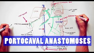 Portocaval Anastomoses  ANATOMY Tutorial [upl. by Piers]