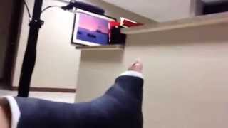 Ankle Fracture Vlog 1  Trimalleolar Fracture [upl. by Ardnasal640]