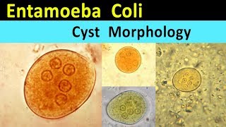 Entamoeba Coli Cyst Morphology [upl. by Thaddus203]