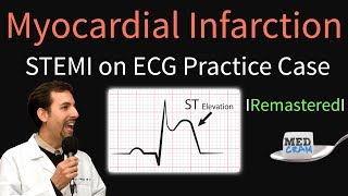 Cardiovascular  Electrophysiology  Intrinsic Cardiac Conduction System [upl. by Llerrud]