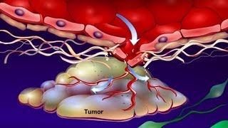 Introduction to Cancer Biology Part 4 Angiogenesis [upl. by Amber140]