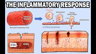 THE INFLAMMATORY RESPONSE [upl. by Zahc]