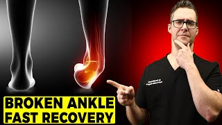 BEST Ankle Fracture amp Broken Ankle Recovery Time 2024 25 BEST TIPS [upl. by Aldredge396]