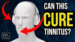 New Tinnitus Treatment Update  Bimodal Neuromodulation from Lenire [upl. by Ardy]