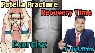 Patella Fracture Recovery Time after surgery  Patella Fracture Recovery Exercises In Hindi [upl. by Mazlack18]