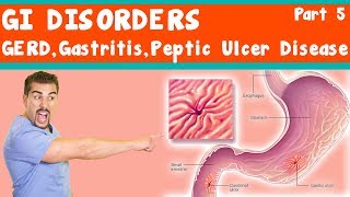 GI Disorders GERD Gastritis peptic ulcer Disease Part 5 [upl. by Yenroc]