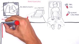 Acute Coronary Syndrome DETAILED Overview MI STEMI NSTEMI [upl. by Fortunna]