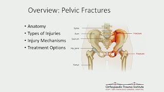 Distal radius fracture recovery [upl. by Schreck527]