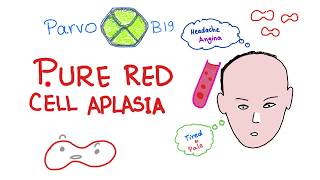 Pure Red Cell Aplasia PRCA  Parvo B19 Virus  Hematology [upl. by Emlynne]