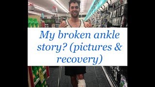 My Broken Ankle Recovery Trimalleolar Fracture with Dislocation [upl. by Odradlig]