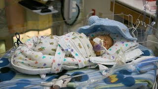 Born at 25 Weeks MicroPreemie Documentary [upl. by Huber]