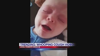 Whooping cough – a family’s experience video [upl. by Ennaeel]