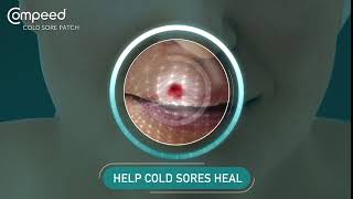 How Compeed Cold Sore patches help cold sores heal [upl. by Vokay]