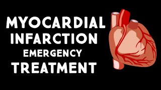 Myocardial Infarction Heart Attack for Nursing amp NCLEX [upl. by Puttergill265]