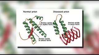 Legionnaires’ Disease  Causes Pathophysiology Symptoms Diagnosis Treatment [upl. by Mannes]