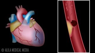 The Heart Part 1  Under Pressure Crash Course Anatomy amp Physiology 25 [upl. by Rufus]