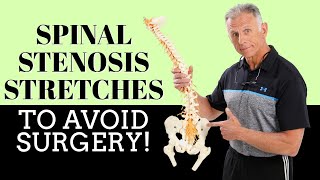 Best 3 Stretches To Quickly Remedy Lumbar Spinal Stenosis amp Avoid Surgery [upl. by Godewyn666]