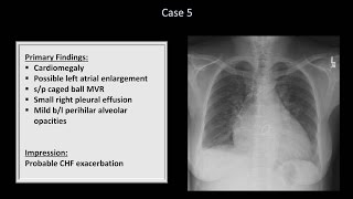 How to Interpret a Chest XRay Lesson 10  Self Assessment Part 1 [upl. by Supmart]