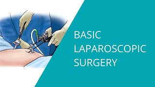 Basic Laparoscopic Surgery [upl. by Naimerej]