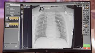 CARESTREAM Image Suite Software with DRXDetector Xray Imaging [upl. by Hassett38]