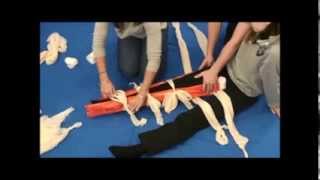 Splinting Lower Leg Fracture [upl. by Jacobine]