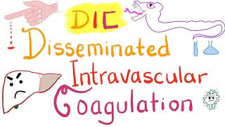 Disseminated Intravascular Coagulation DIC [upl. by Pollak]