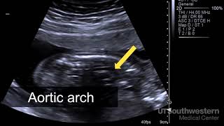 Overview of the Endocrine System [upl. by Akiemahs]